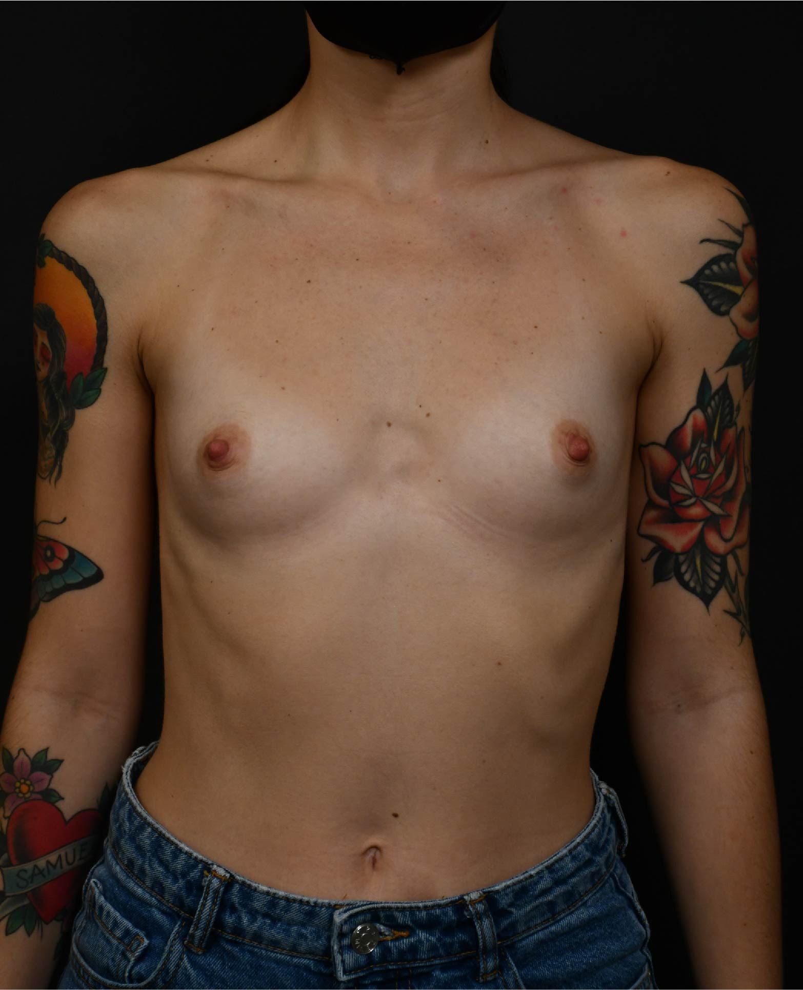 before and after