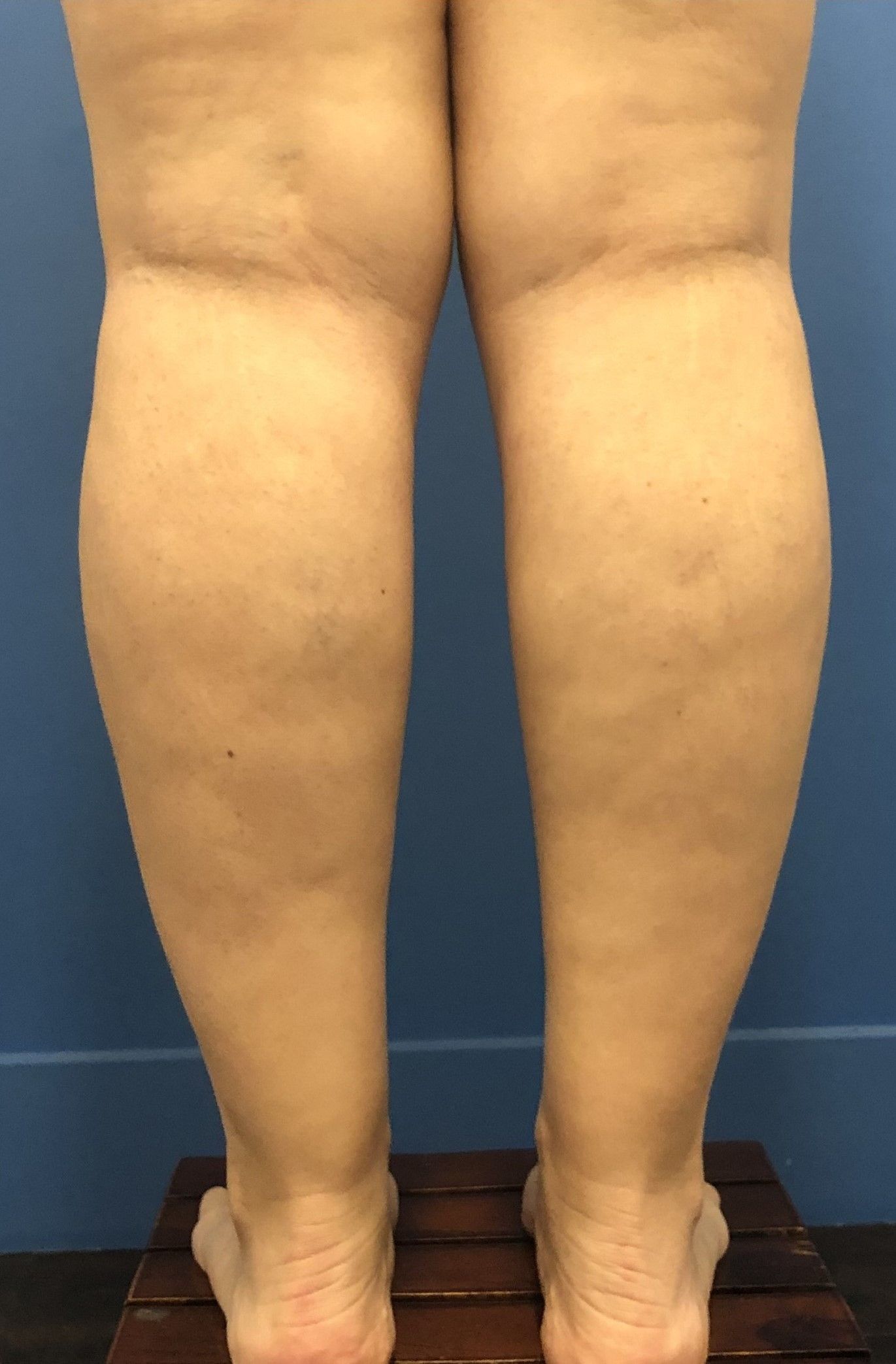 before and after