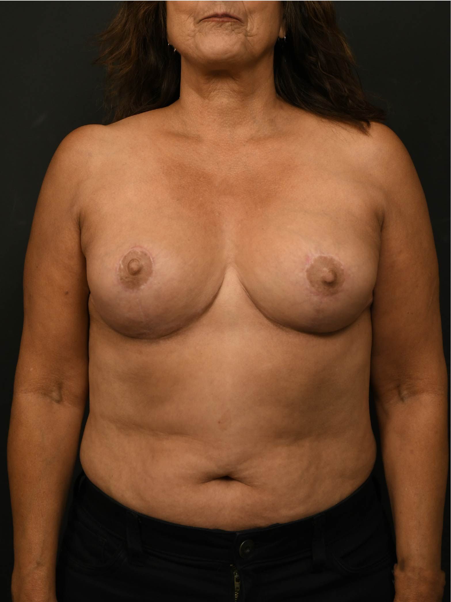 before and after