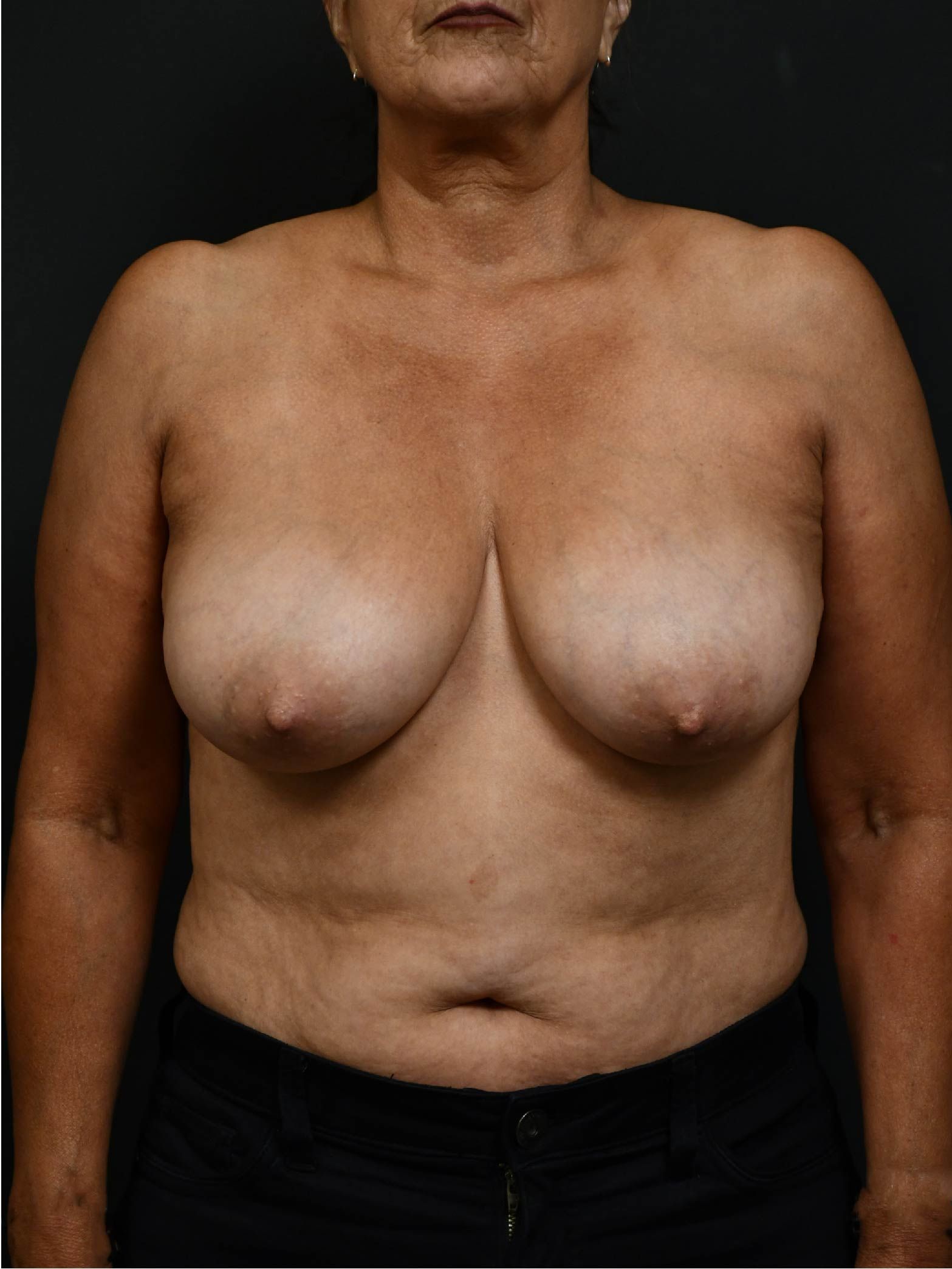 before and after
