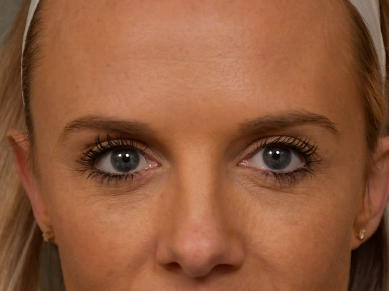 patients at Change Plastic Surgery
