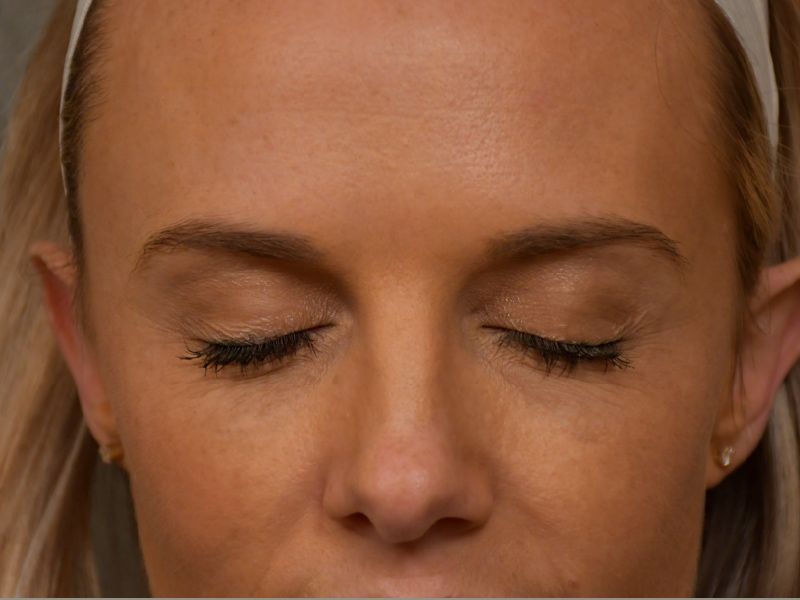patients at Change Plastic Surgery