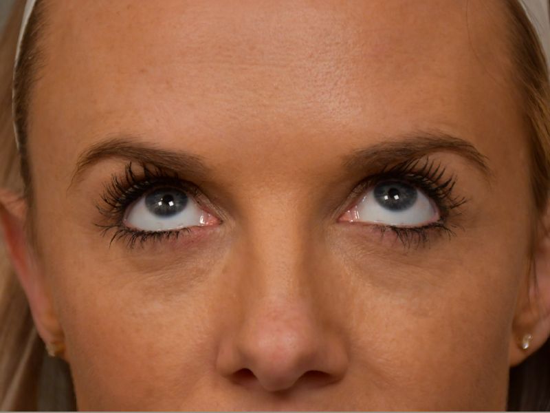 patients at Change Plastic Surgery