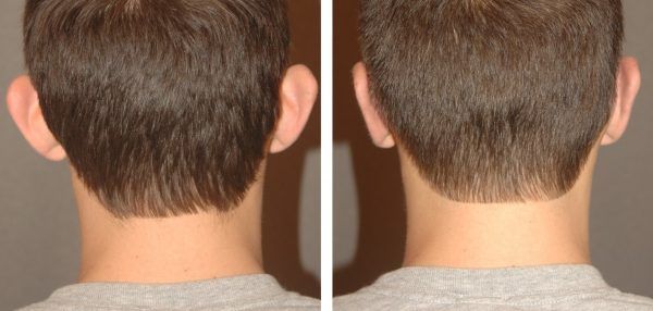 Man with alrge ears