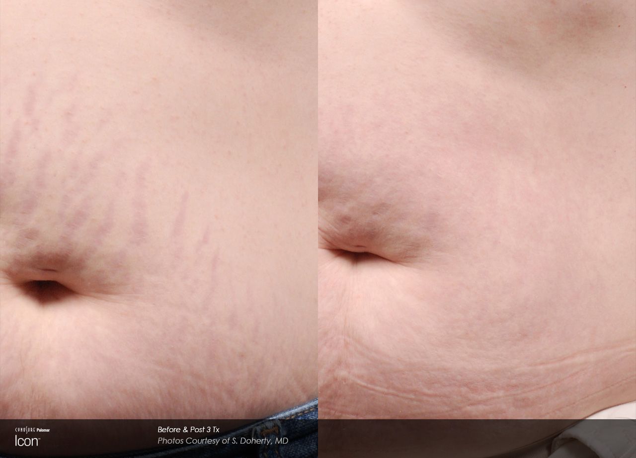 close up before and after