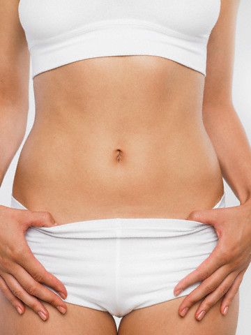 Tummy tuck