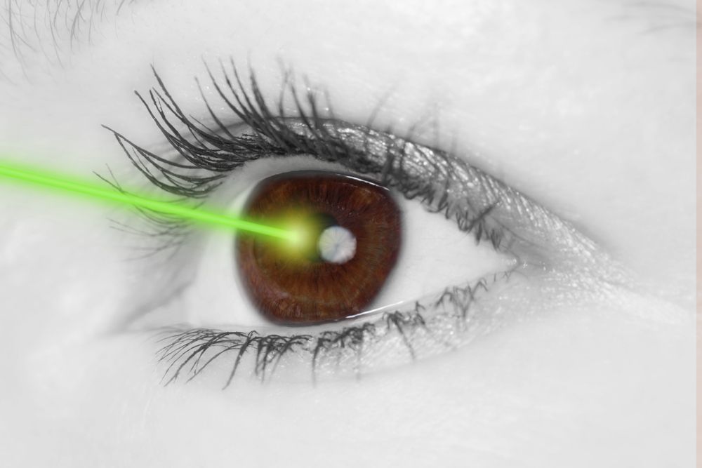 eye laser therapy