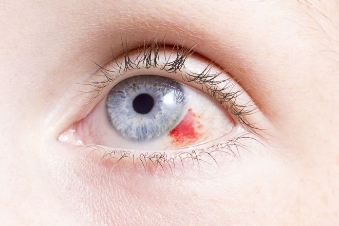 Eye Trauma Treatment in White Plains