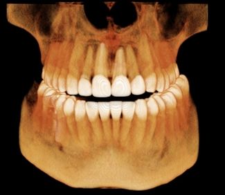 3d scan dental x-rays