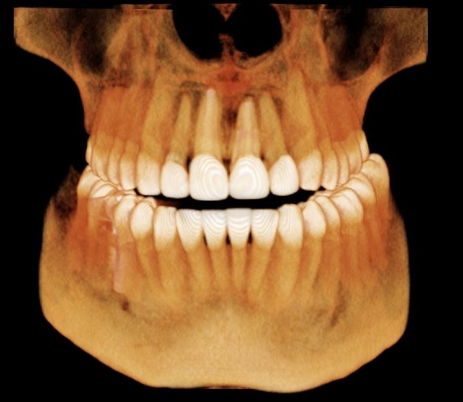 dental exam in palm beach gardens