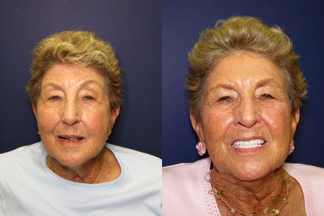 periodontal dentist decay