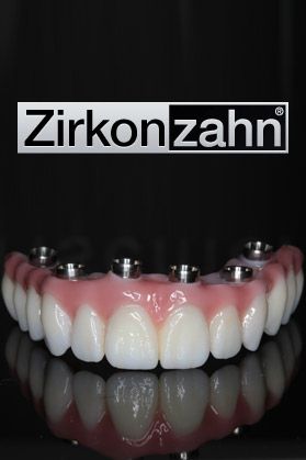 dental bridges zirkon zahn