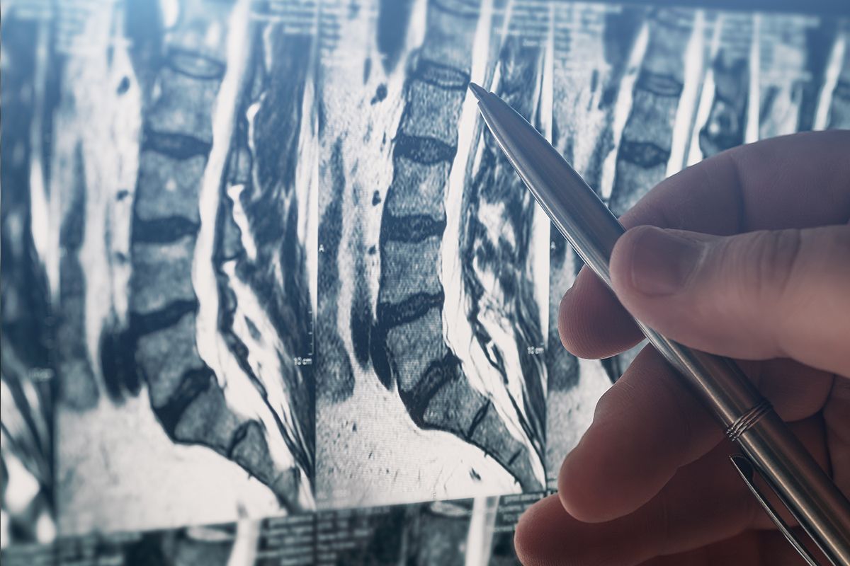 Disc Injuries