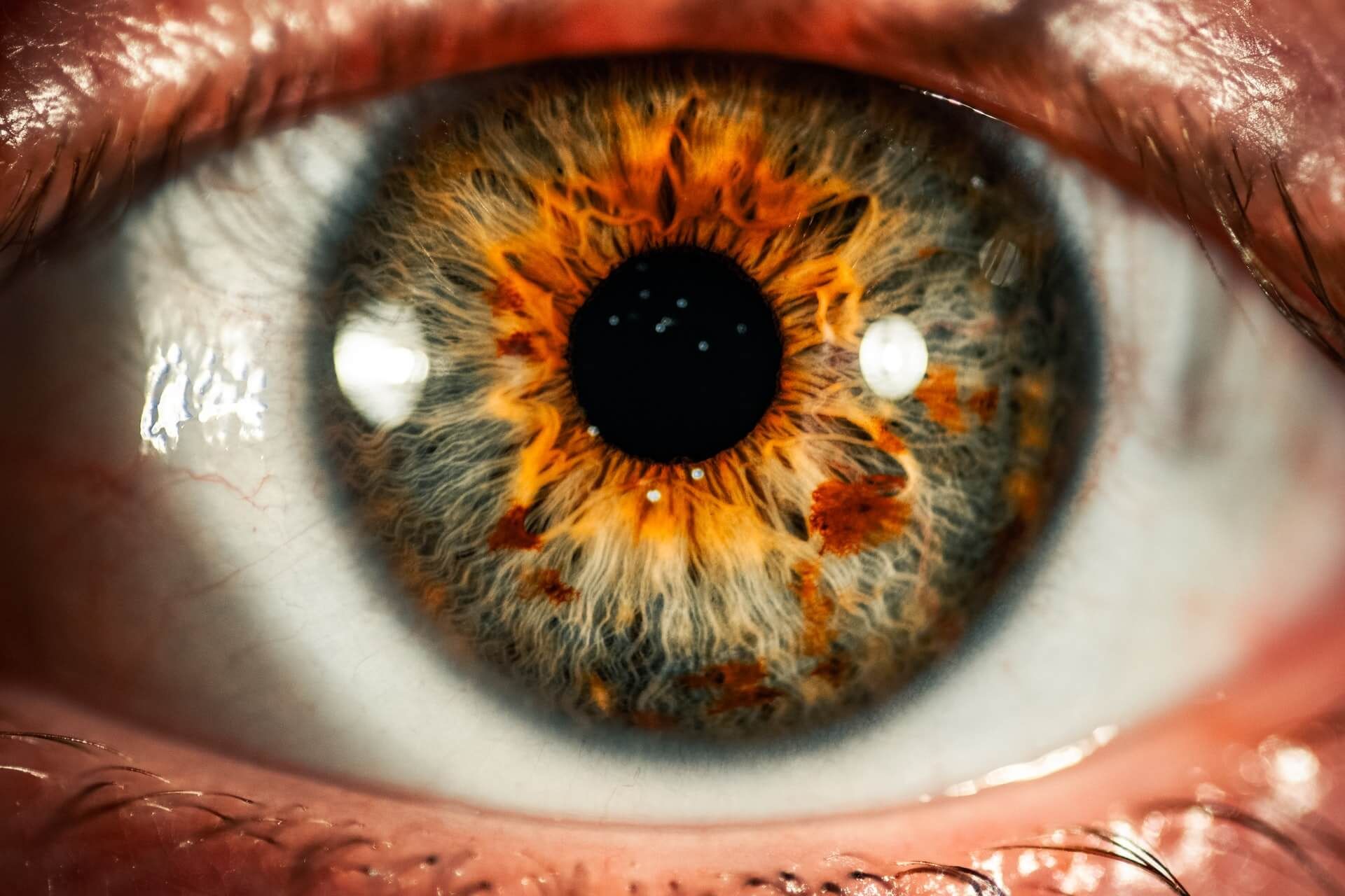 How Does Sjogren’s Syndrome Affect the Eyes?