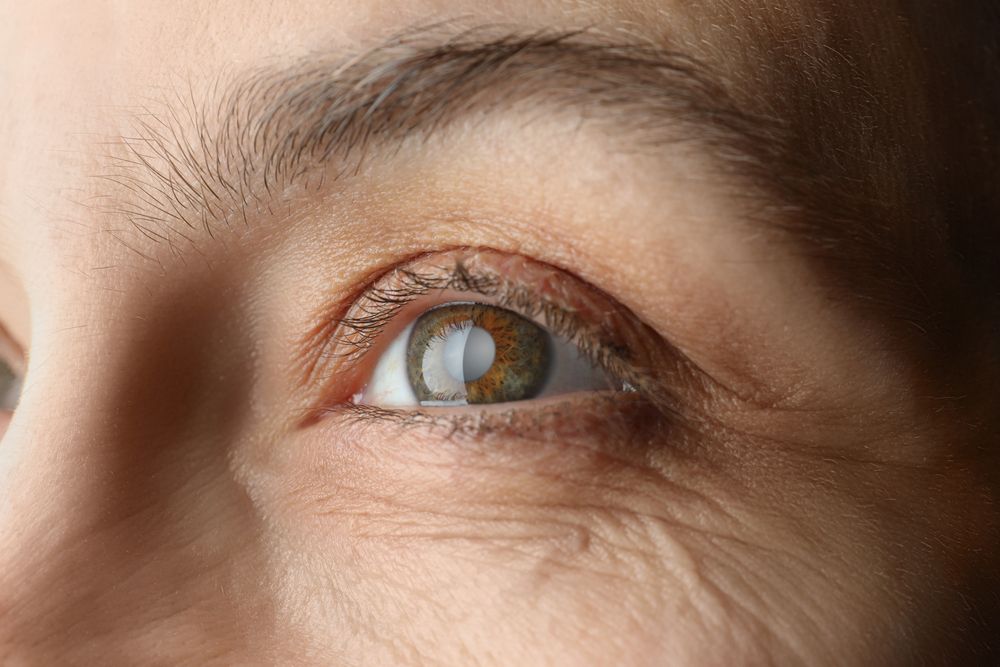 Common Symptoms of Glaucoma