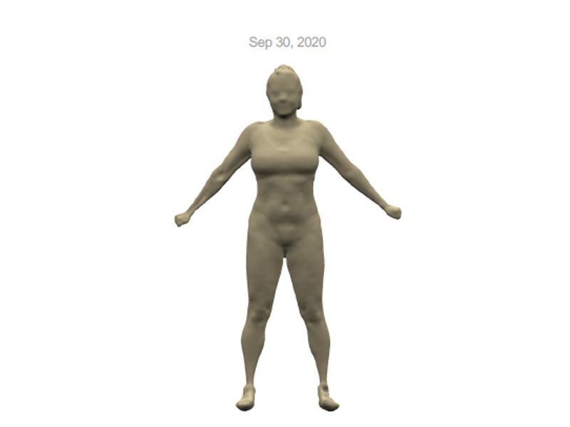 after liposuction
