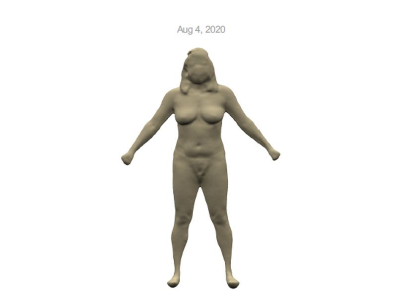 before liposuction