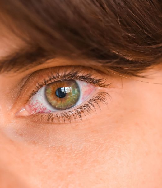 Optometrist in Elgin Small Wonder Eye Care