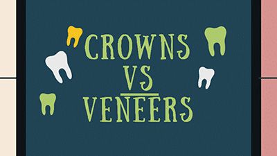 Crown vs. Veneers
