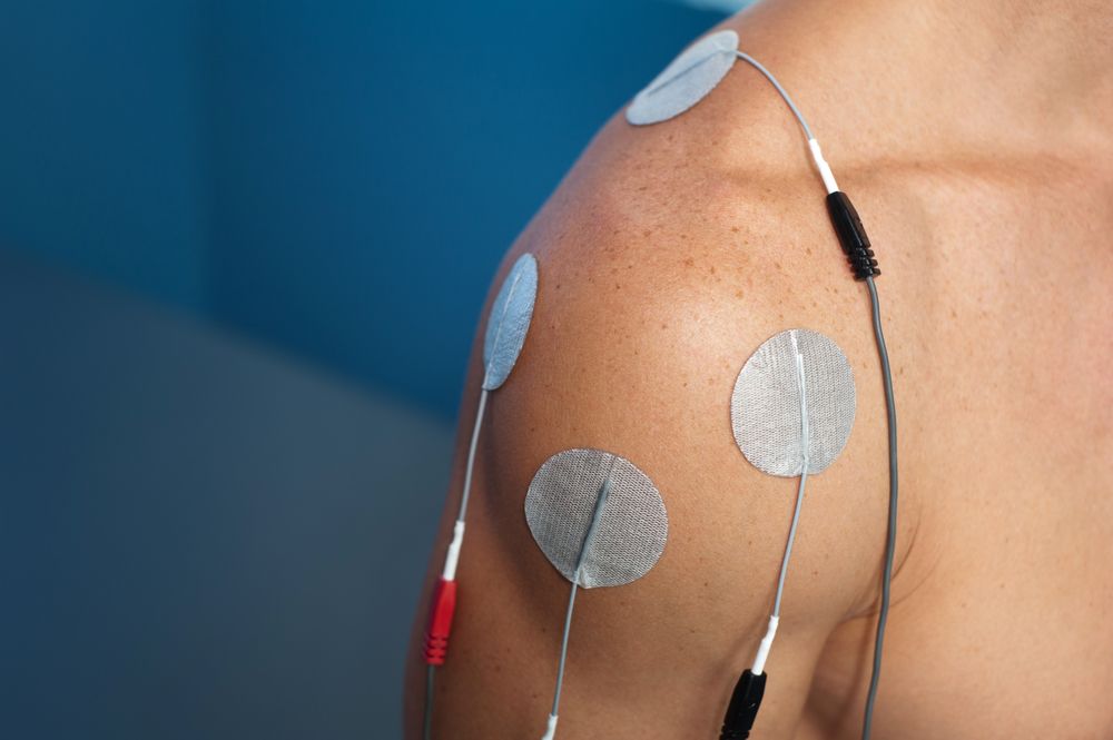 8 Benefits of Electrical Stimulation Therapy