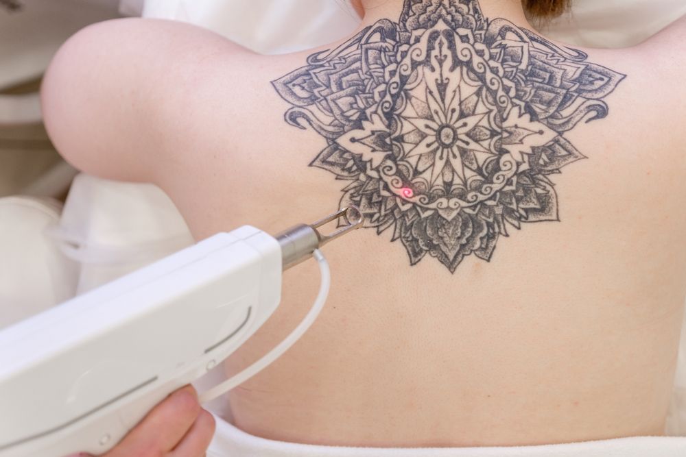 The Most Uncomfortable Areas to have Tattoos Removed
