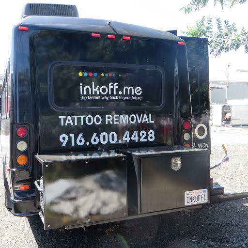 Mobile Tattoo Removal