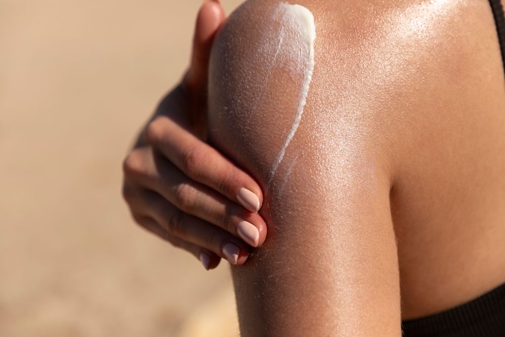 Should I Wear Sunscreen After Tattoo Removal?