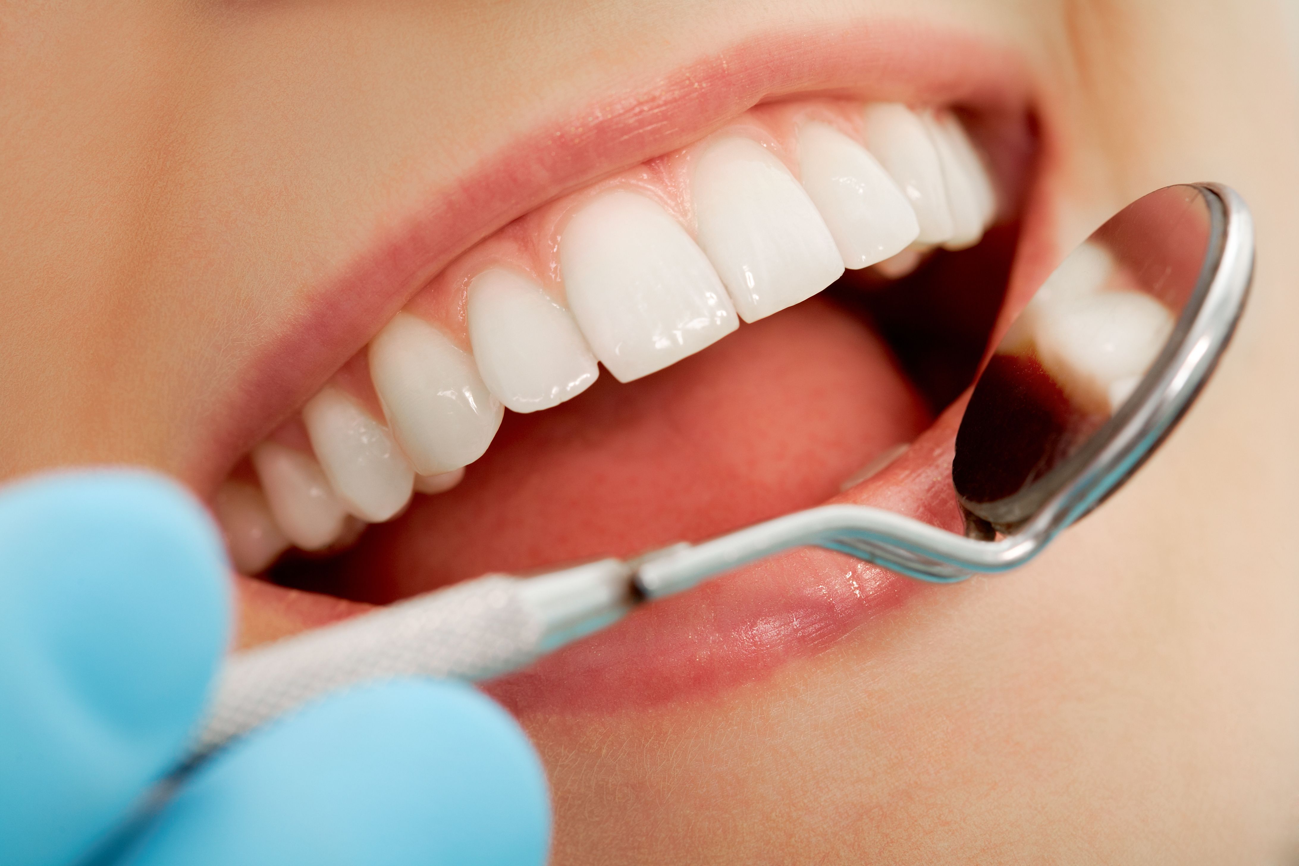 Signs and Symptoms of Gum Disease (Periodontal Disease)