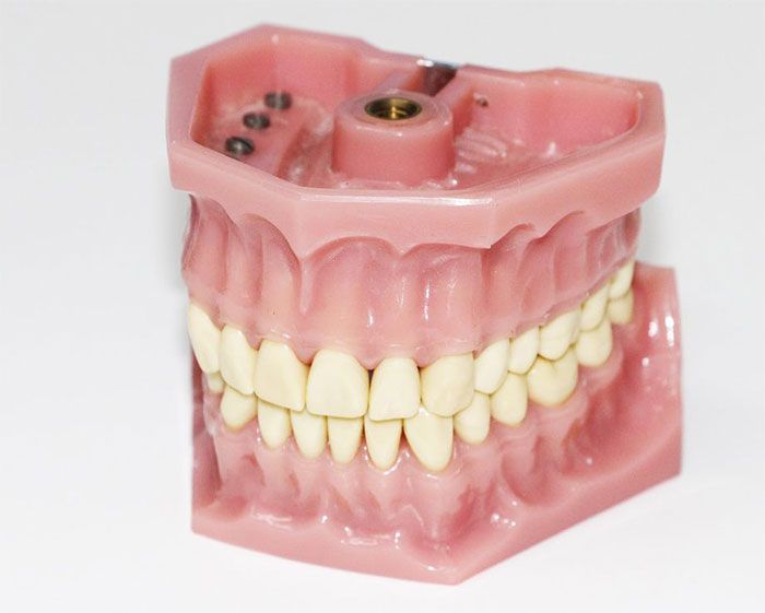 dentures