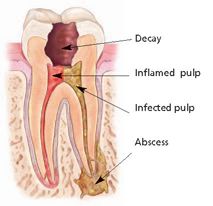 root canal anatomy
