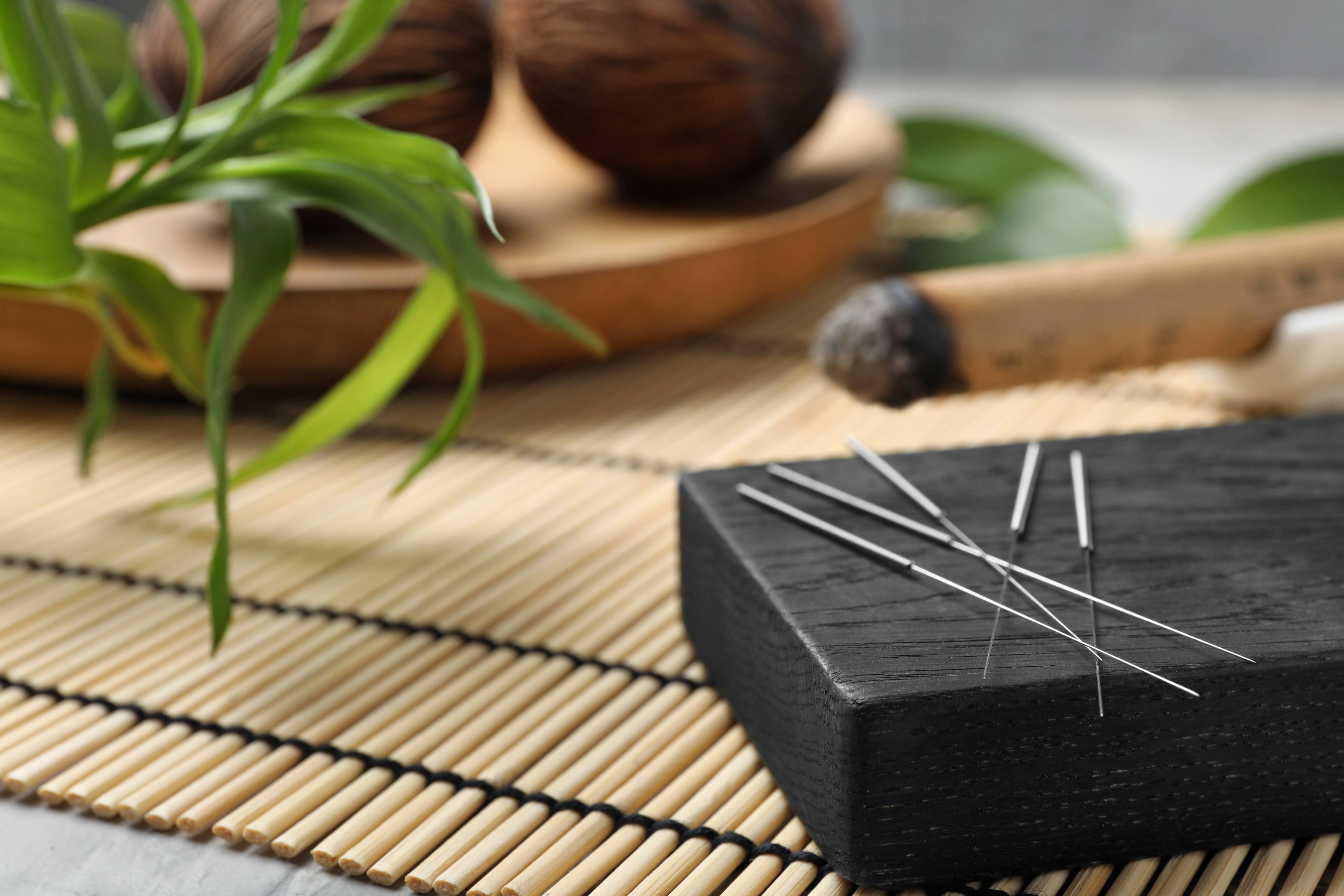 5 Conditions That Can Be Treated with Acupuncture