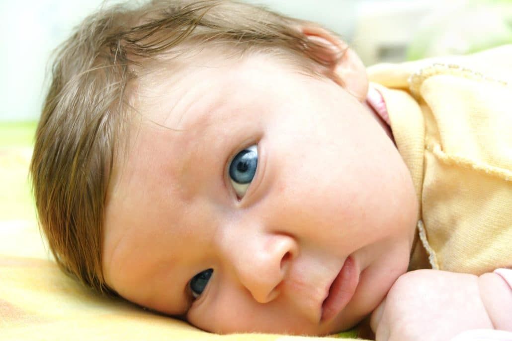 Your Baby Has a Lazy Eye? What to Know