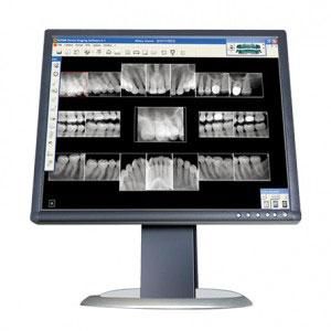 dental xrays