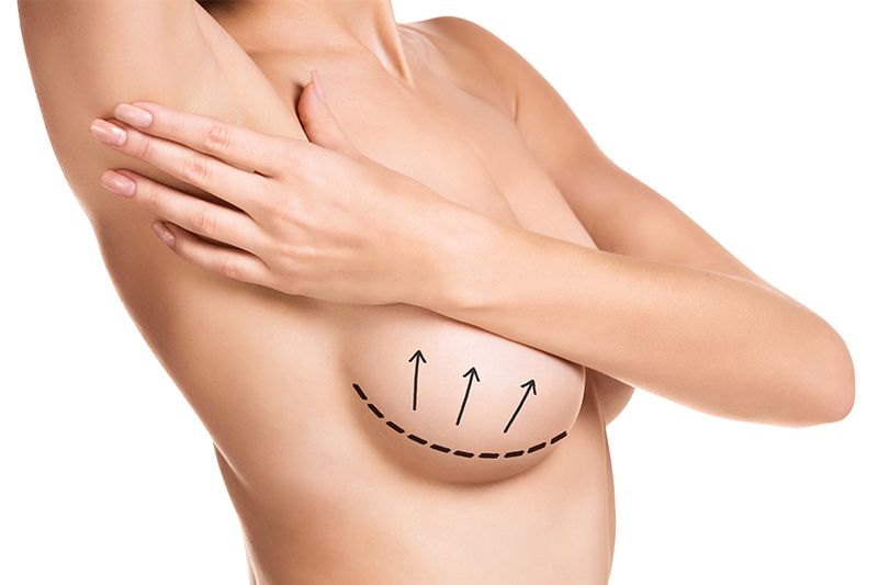 Breast Reconstruction