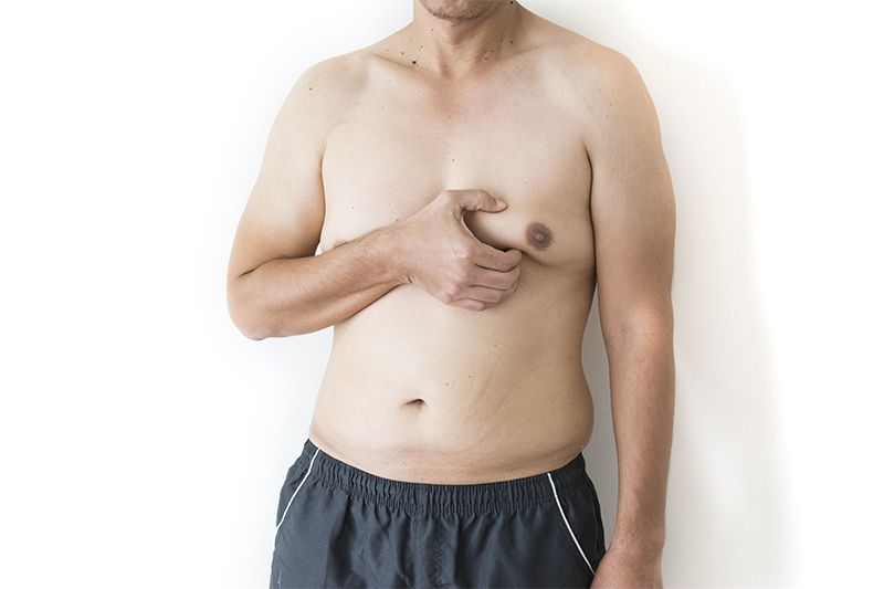 MALE Chest Reduction – Gynecomastia