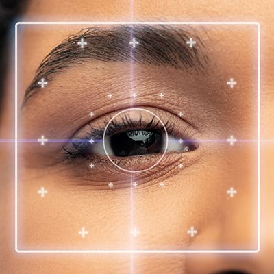 Lasik