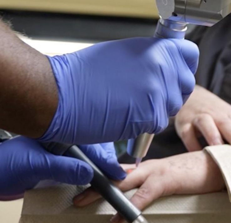 Ink Doctors Mobile Tattoo Removal Experts