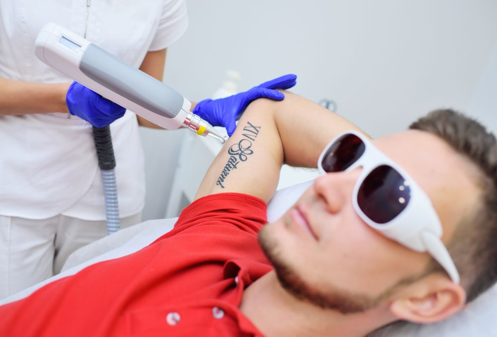 Navigating Laser Tattoo Removal: Understanding Potential Skin Reactions