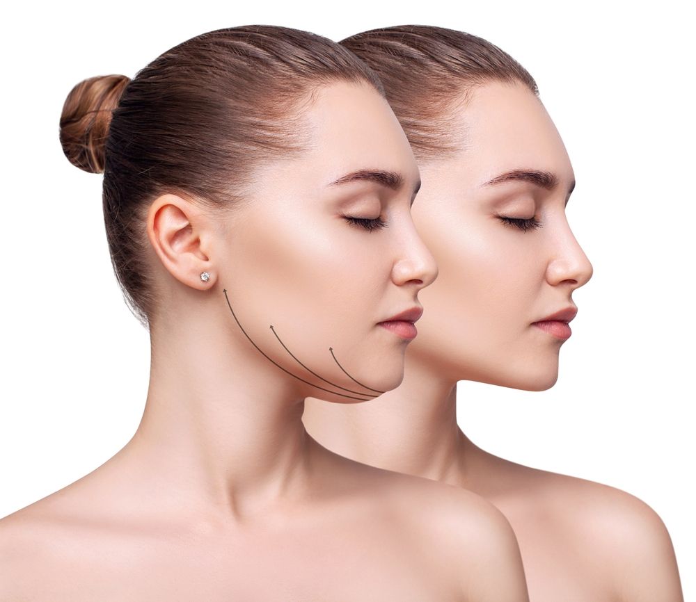 Kybella in Weston