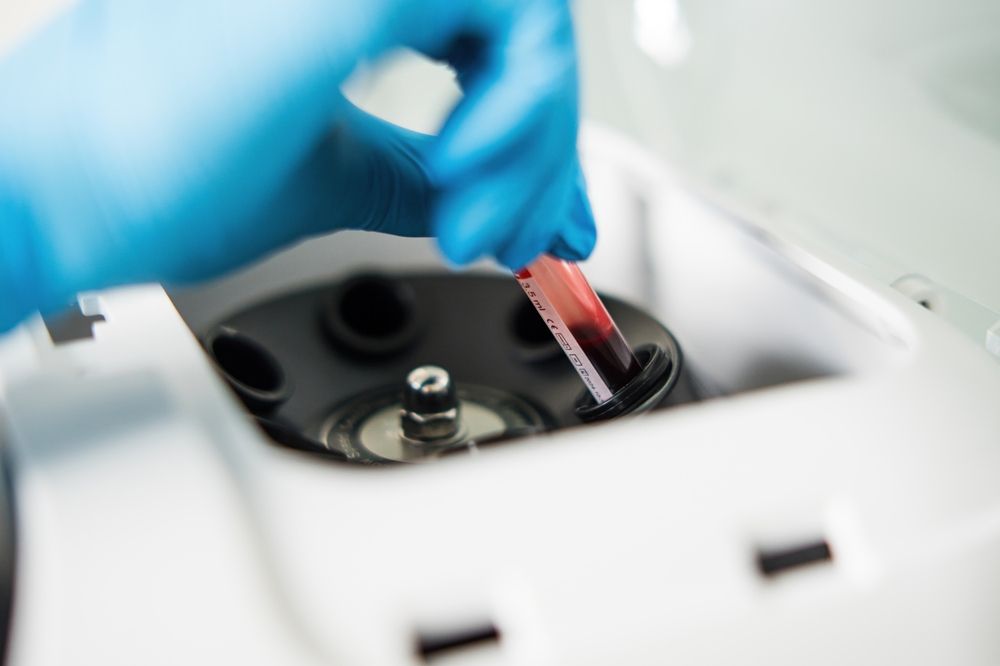 Unlocking Your Health Potential: Understanding Blood Chemistry Analysis