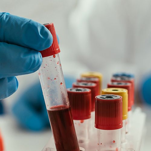 Blood Chemistry Analysis and Nutrition