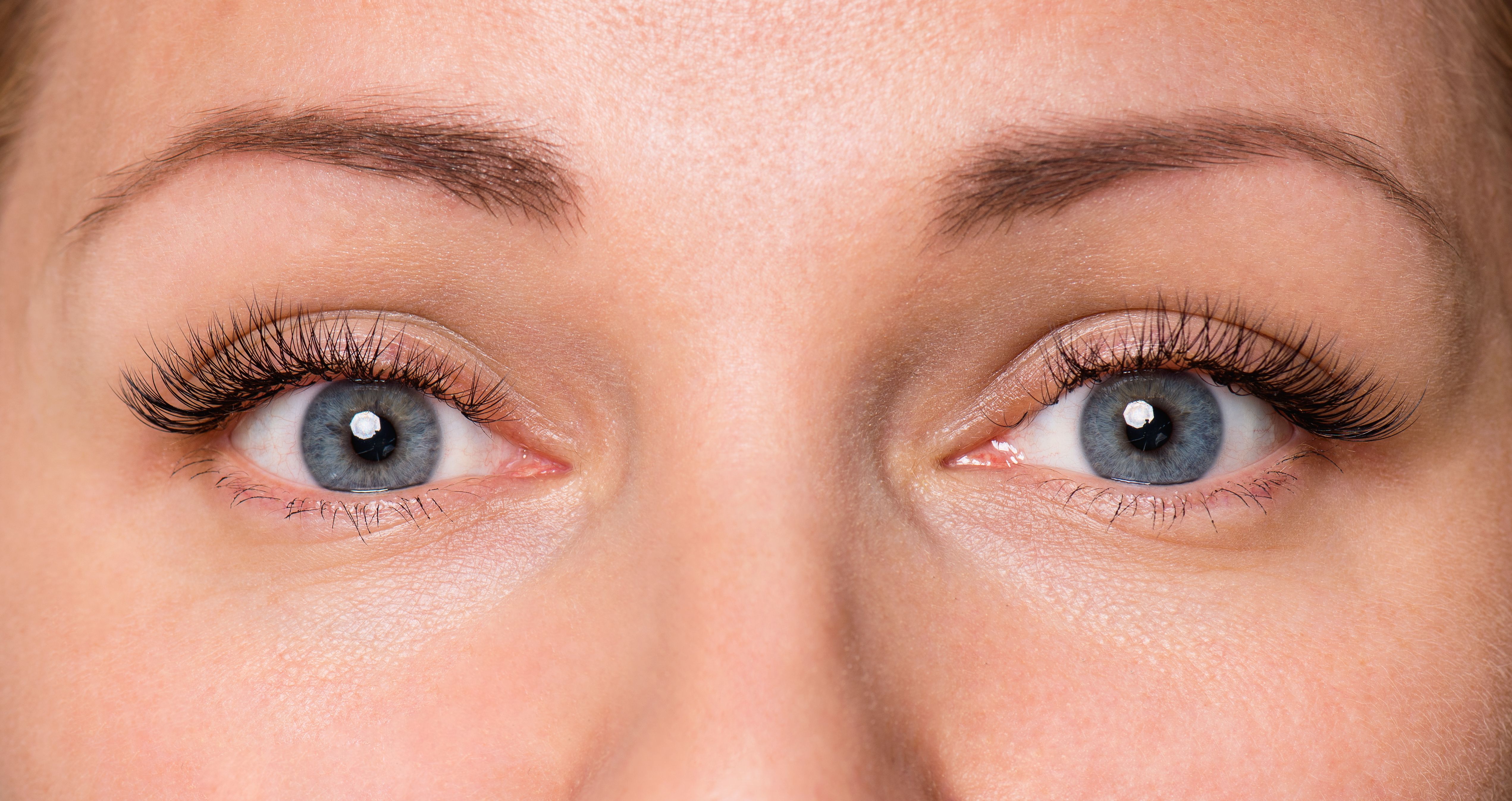 Who Is an Ideal Candidate for Amniotic Membrane Treatment?