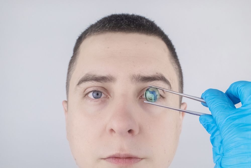 What Is Blade-Free Cataract Surgery and How Does It Work?