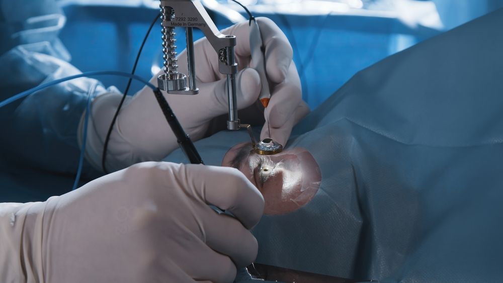 What to Expect During the IntraLase LASIK Procedure