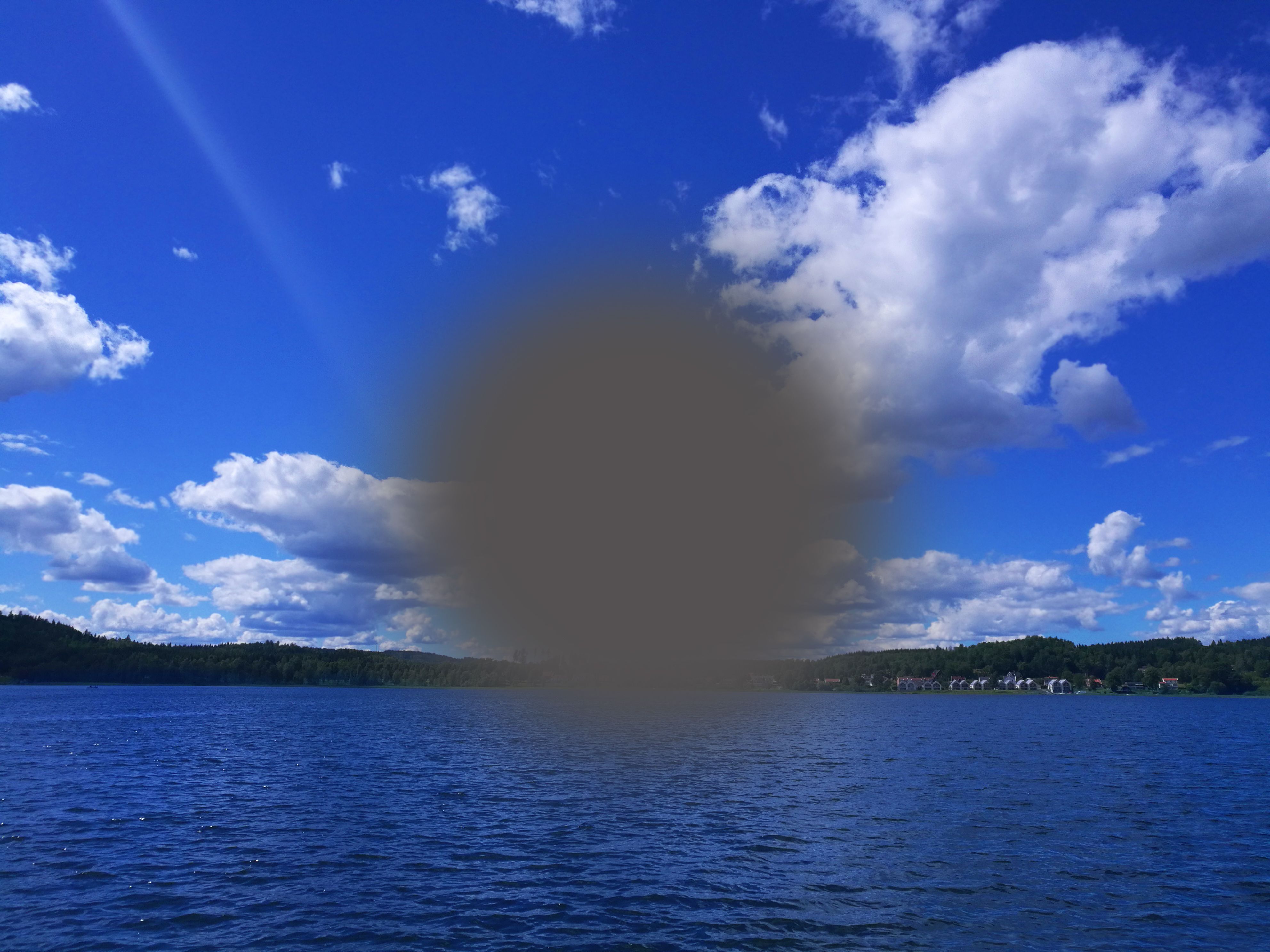 What Are the Stages of Dry Macular Degeneration?