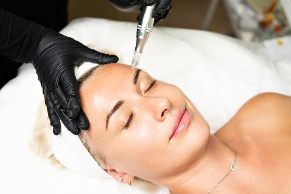 How Microneedling Boosts Collagen and Reverses Fine Lines