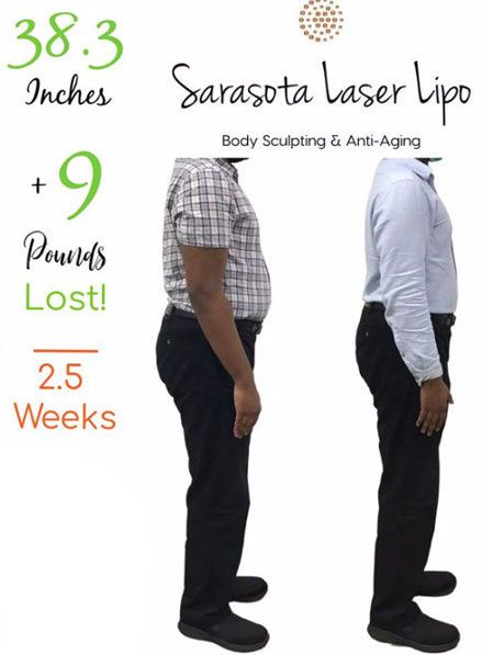 sarasota-weight-loss