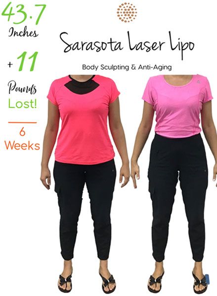 weight-loss-clinic-sarasota