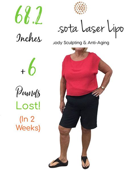 weight-loss-center-sarasota