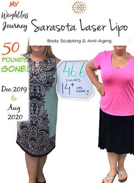 lose-weight-sarasota